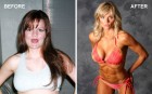 ms_before_and_after.jpg
